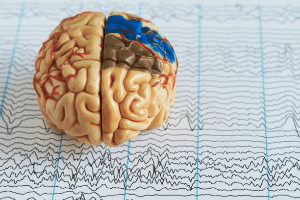Neuromarketing - Definition und 2 Beispiele aus der Praxis 1 Neuromarketing Gehirnscan